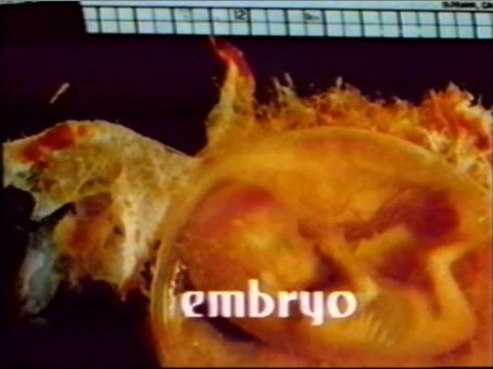 Embryo 1976 w/ Rock Hudson